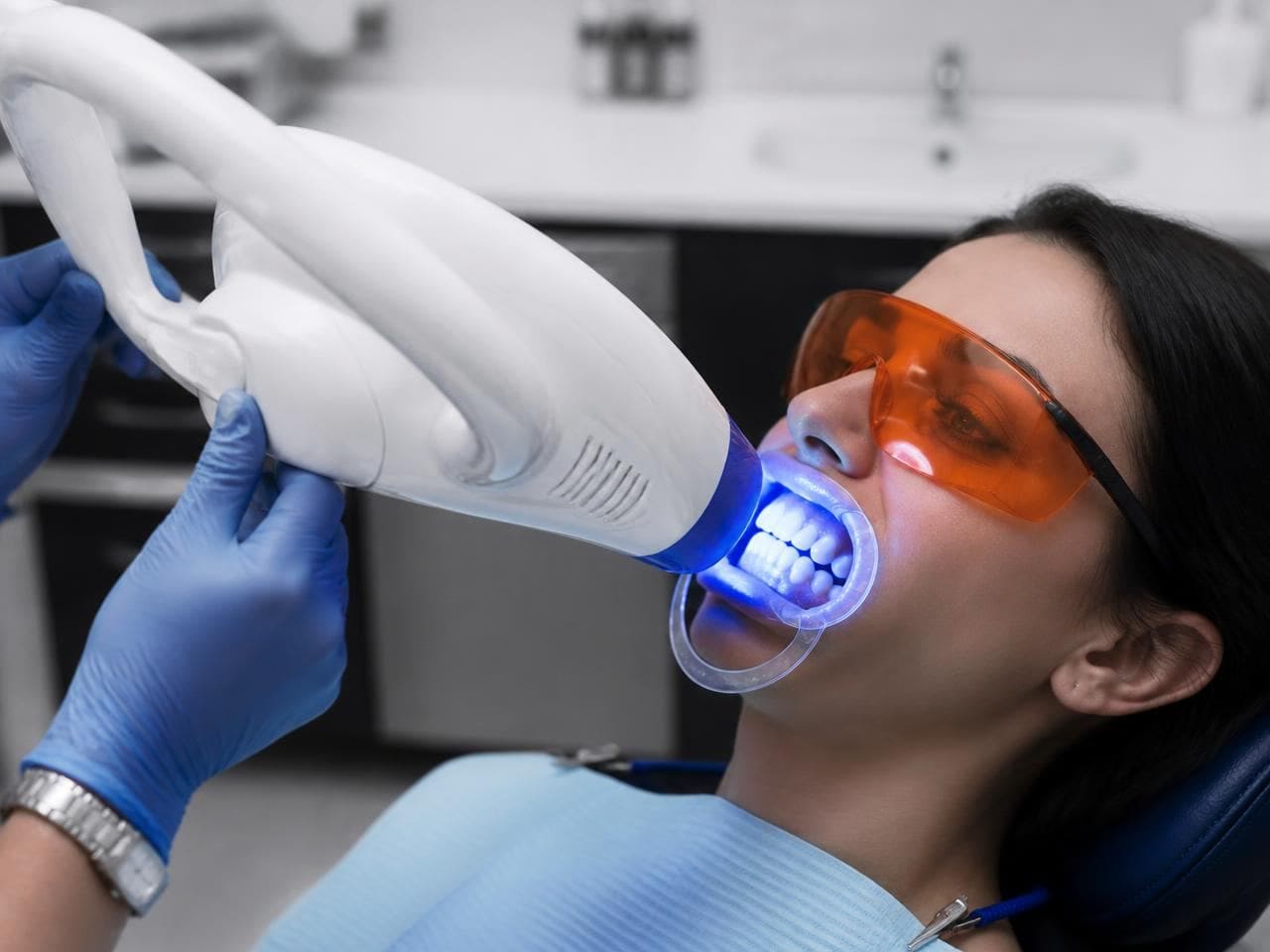 In-clinic teeth whitening with an LED accelerator lamp